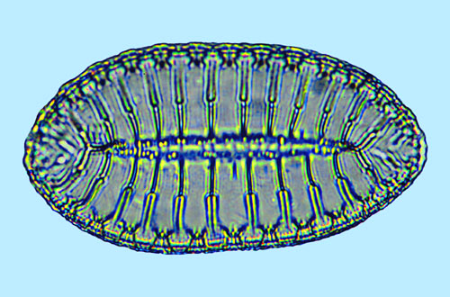 Surirella fastuosa