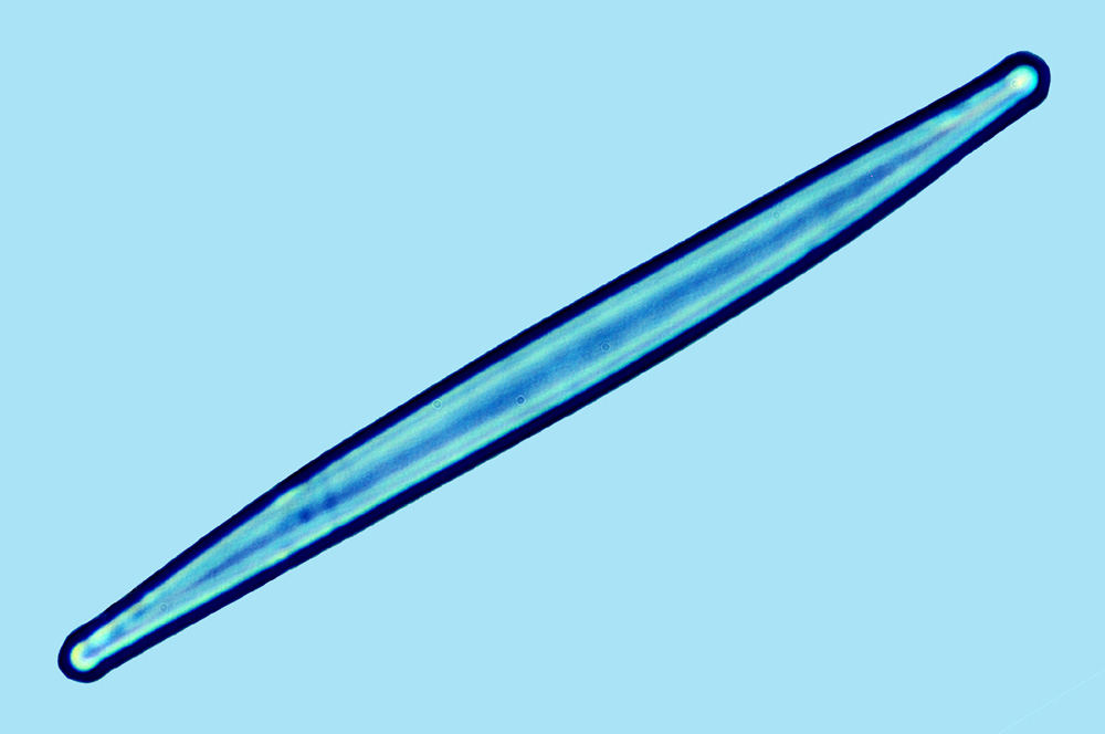 Hyalosynedra laevigata