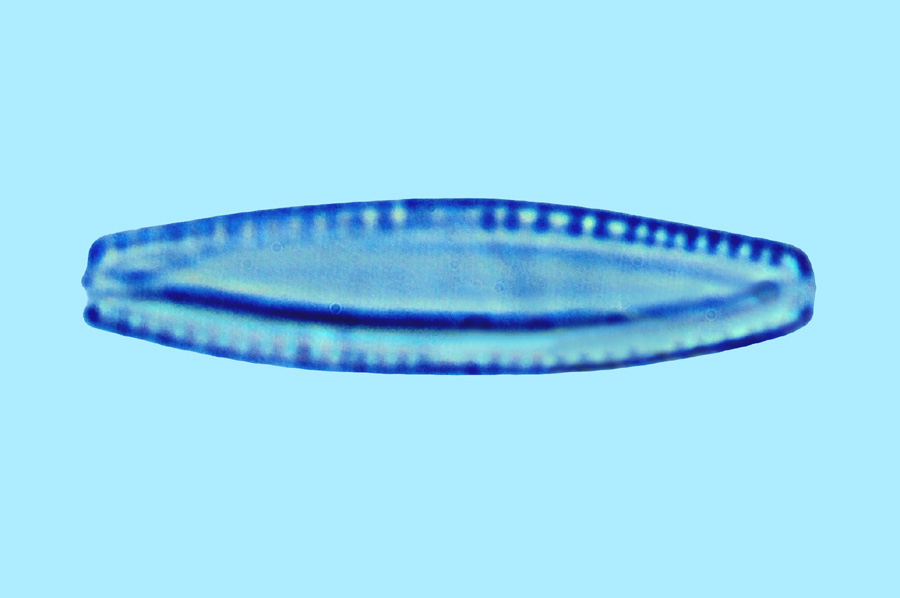 Nitzschia pseudocommunis