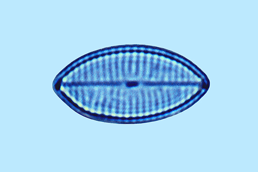 Navicula sp