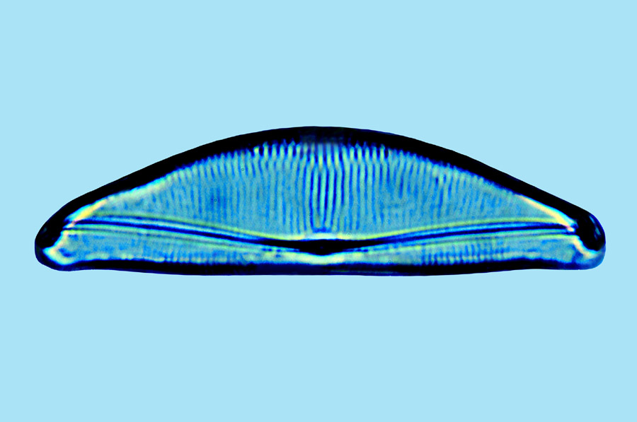 Amphora lineolata