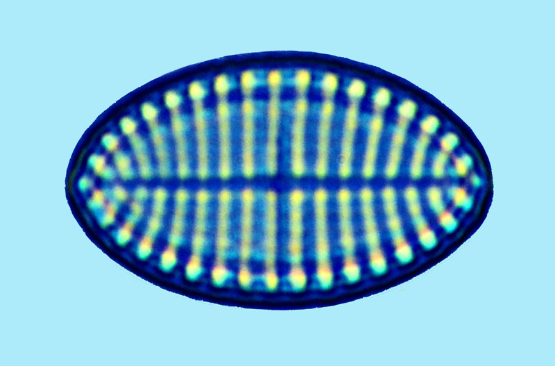 Cocconeis sp cf stauroneiformis