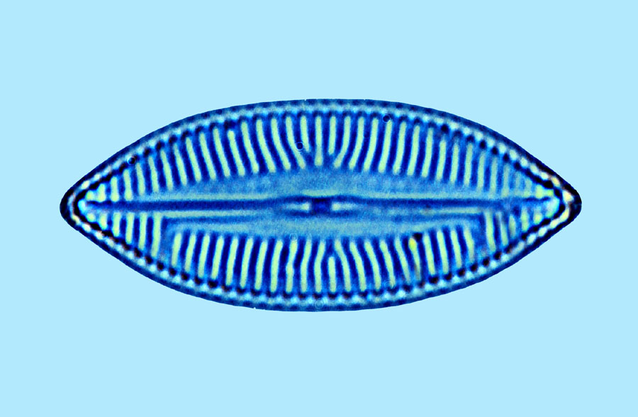 Naviculapalpebrulum
