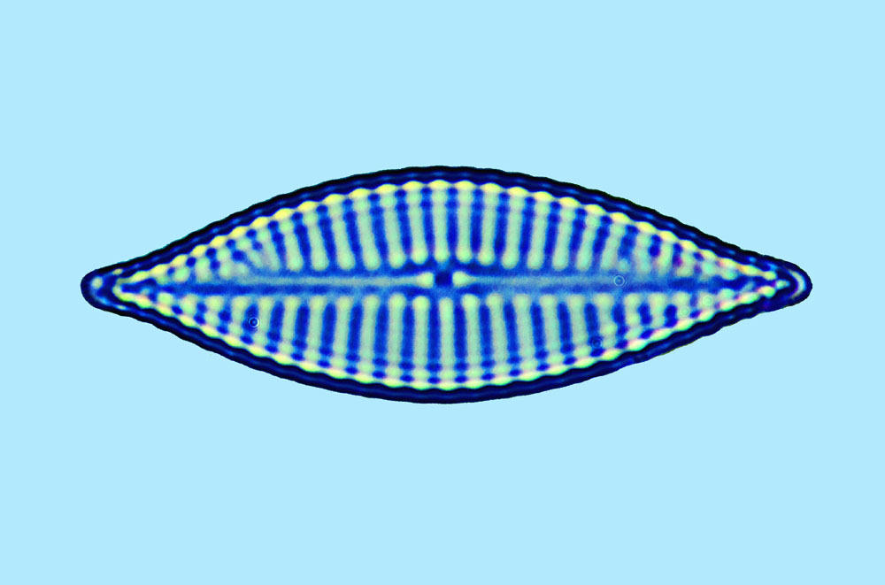 Navicula sp