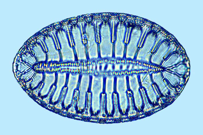 Surirella fastuosa