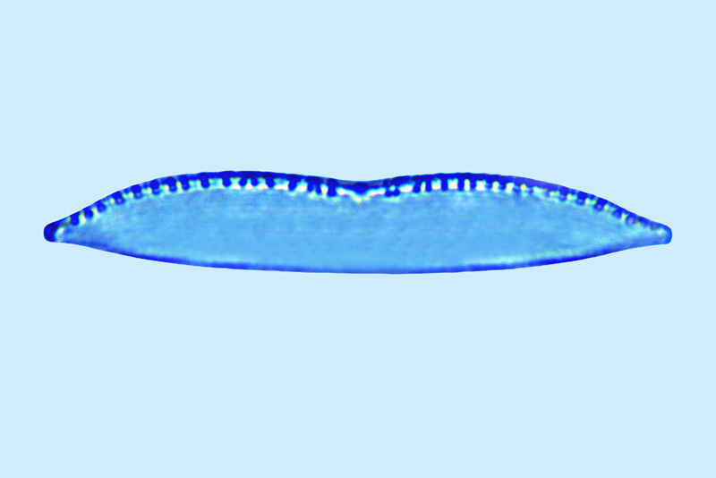 Mediolittoral Nitzschia umbonata