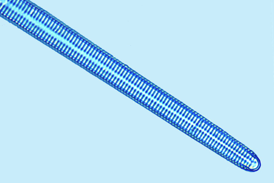 Mediolittoral Synedra ulna
