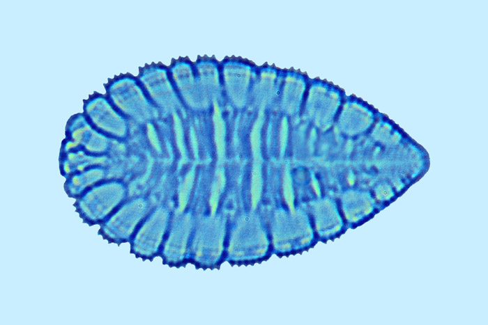 Surirella ovata