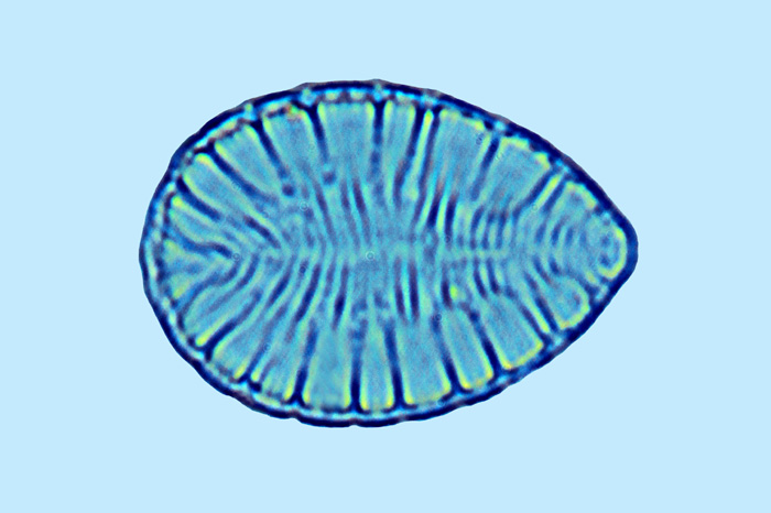 Surirella ovata