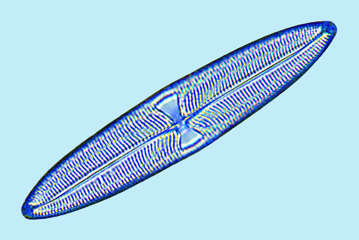 Trachyneis aspera
