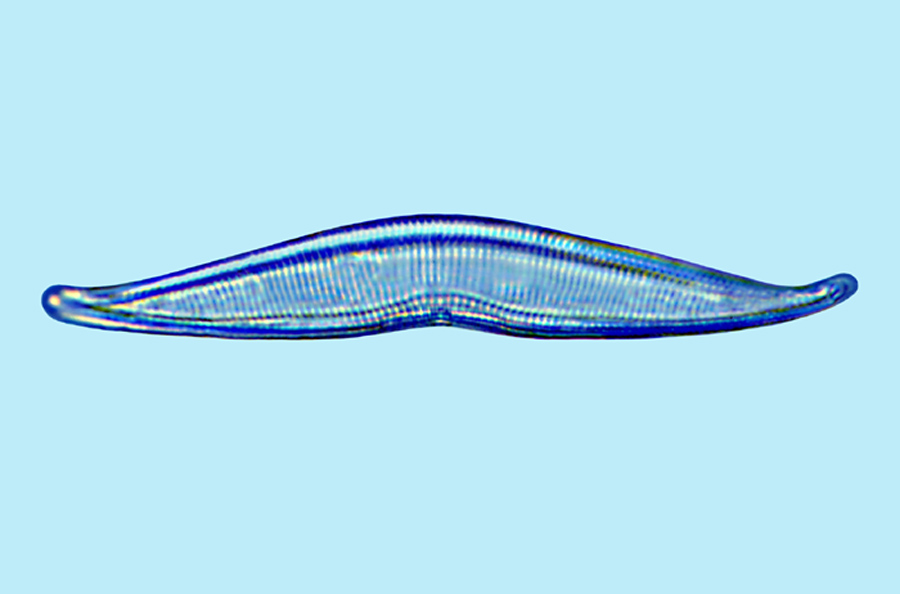 Amphora sp