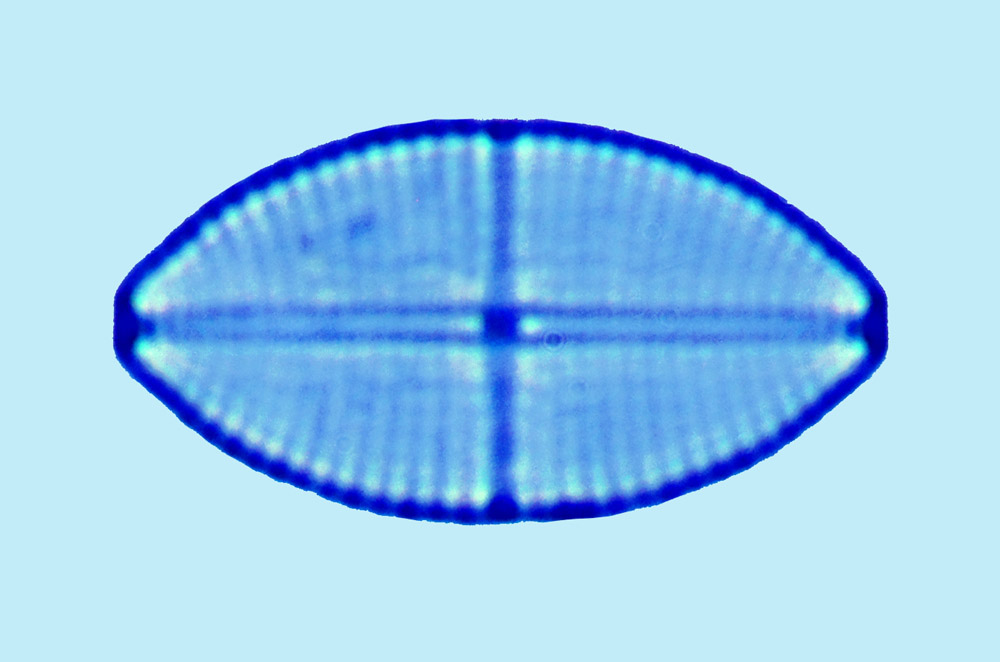 Cocconeis stauroneiformis