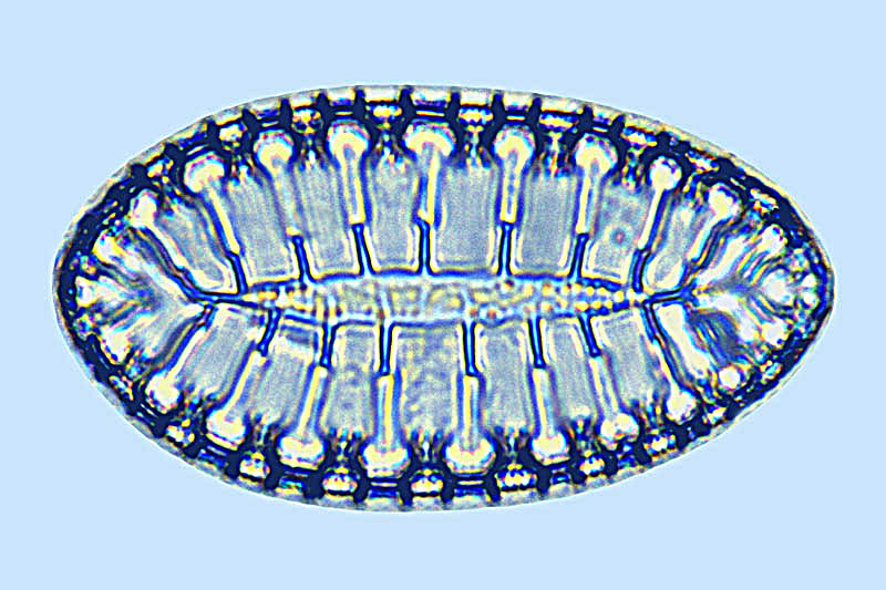 Raphoneis Surirellafluminensis