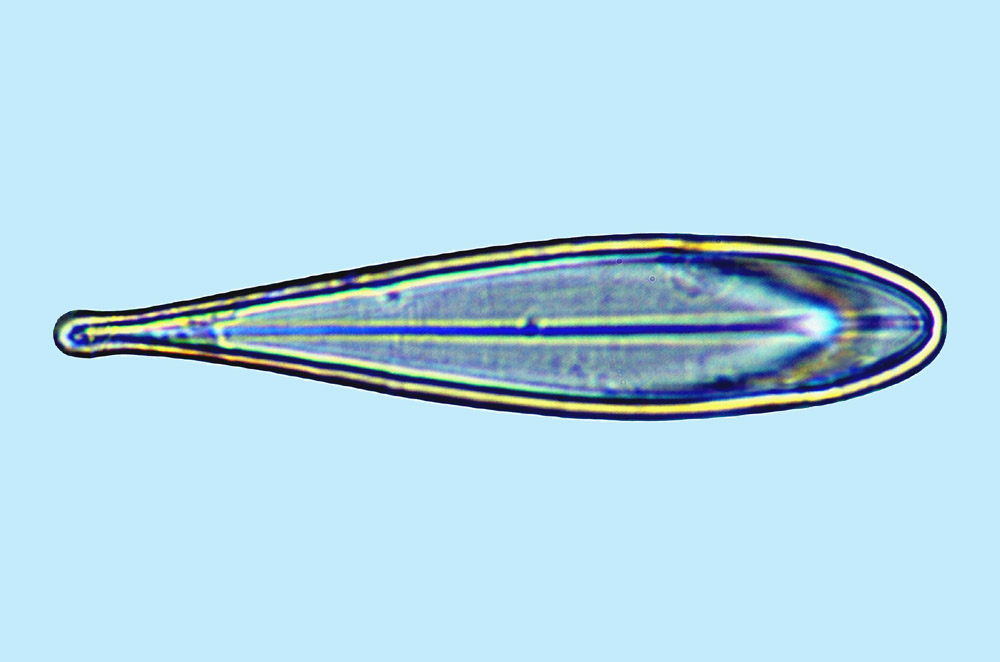 Fallacia Licmophora nubecula