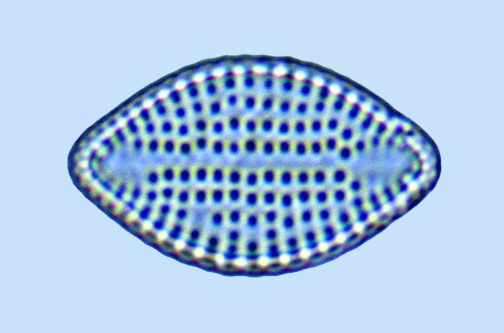 Amcadifa Delphineis surirella