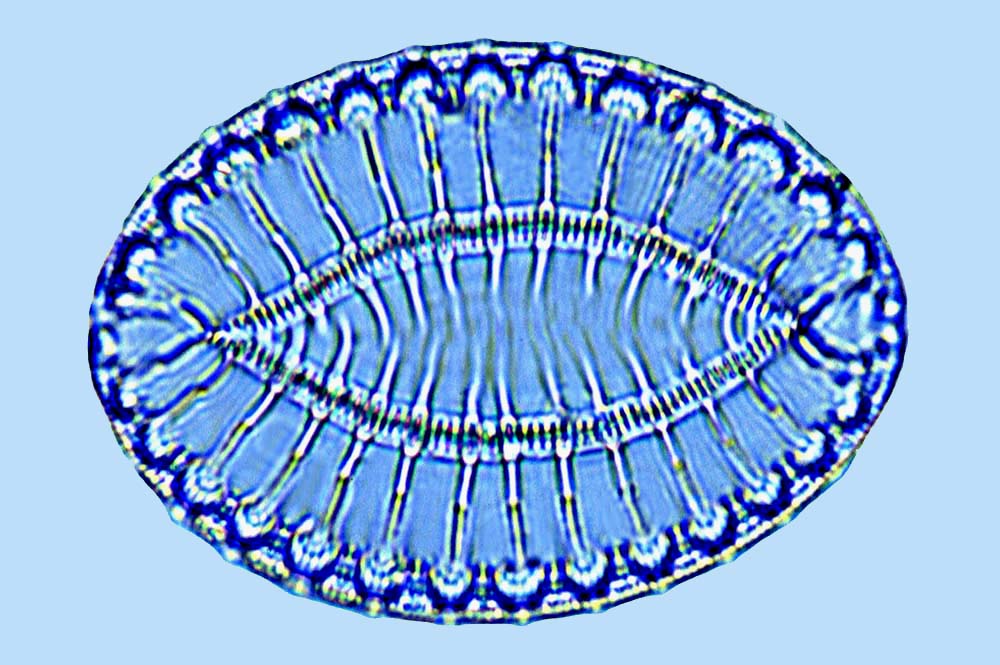 Surirella fastuosa