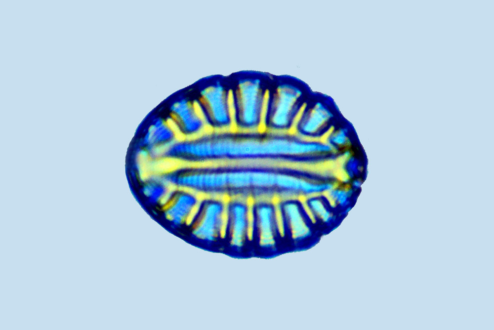 Surirella sp.