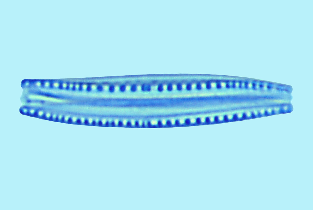 Saumatdeux Nitzschia clausii