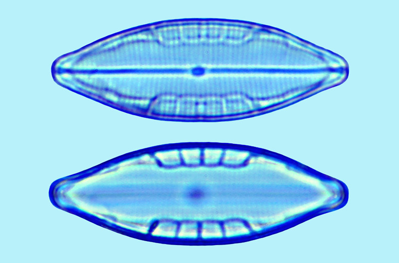 Mediolittoral Mastogloia acutiuscula