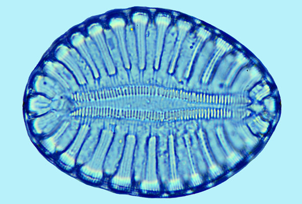 Surirella fastuosa