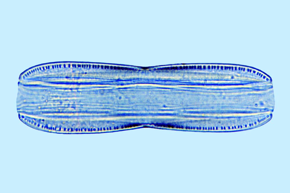 Nitzschia pellucida
