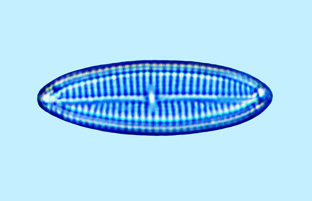 Navicula sp