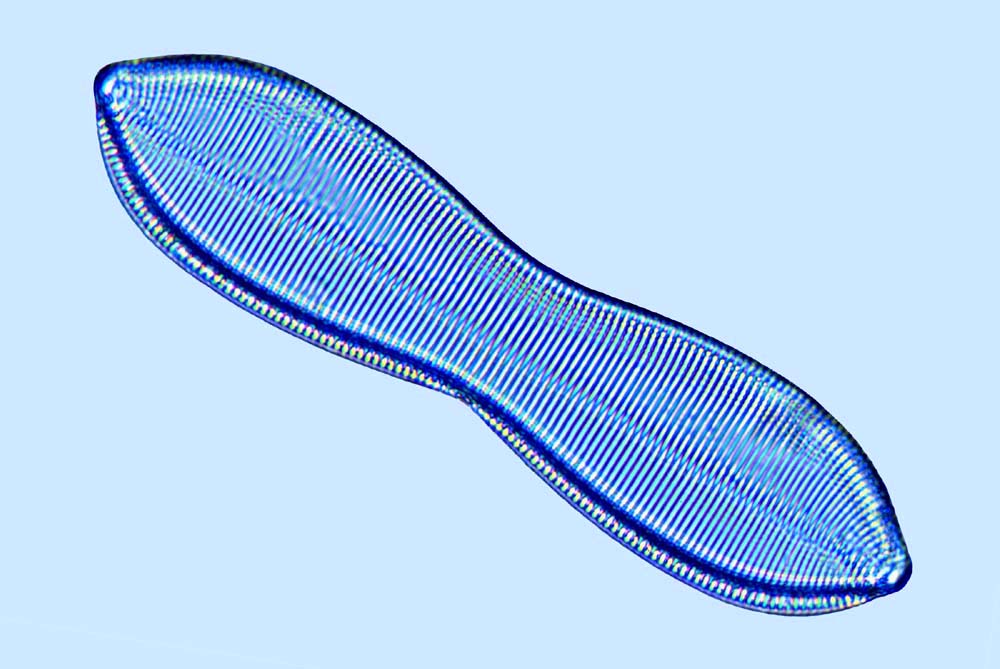 Nitzschia sp