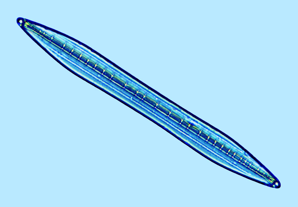 Nitzschia sp