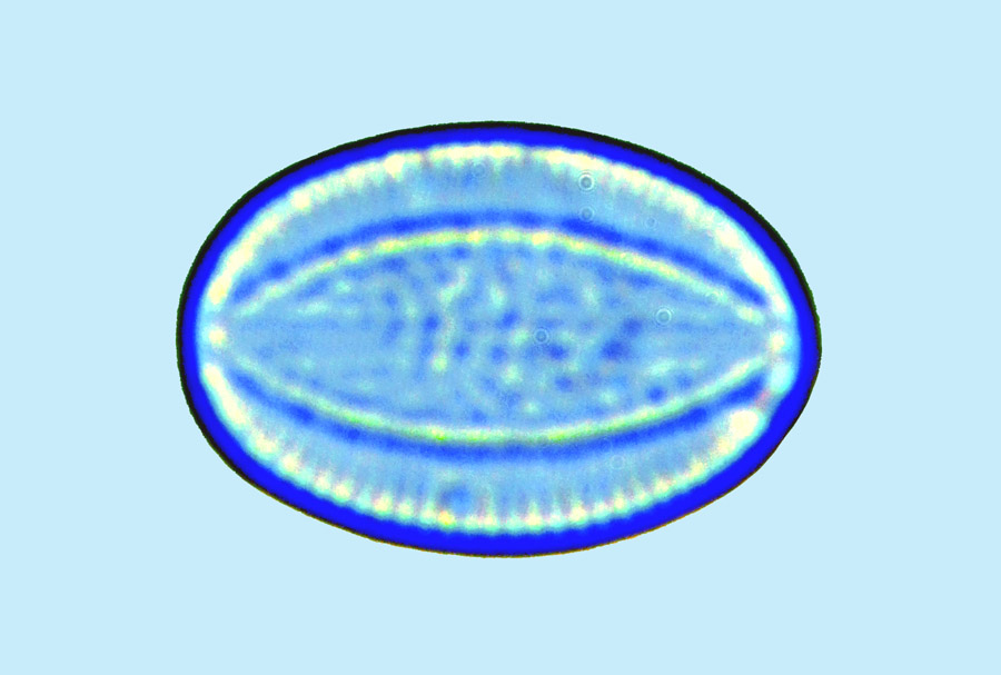Mediolittoral Cocconeis pelta