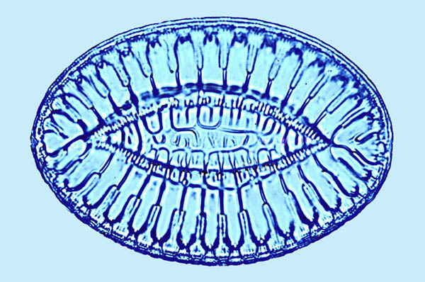 Surirella fastuosa