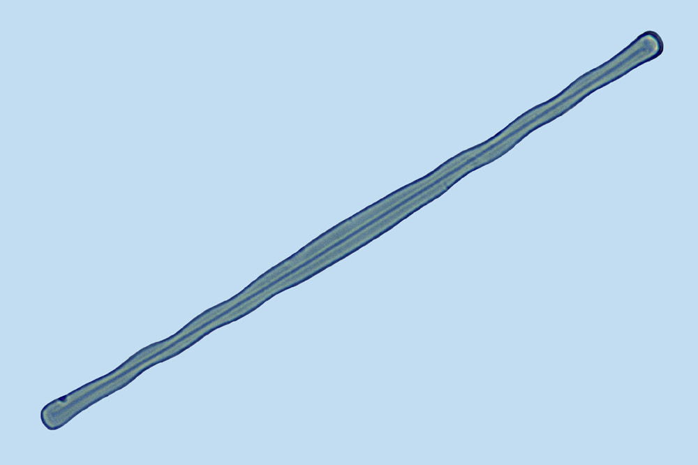 Lyresurimart Neosynedra tortosa