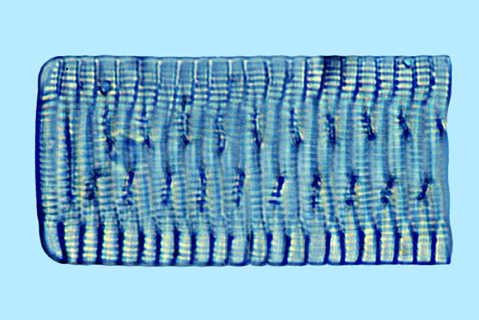 Rhabdonema adriaticum
