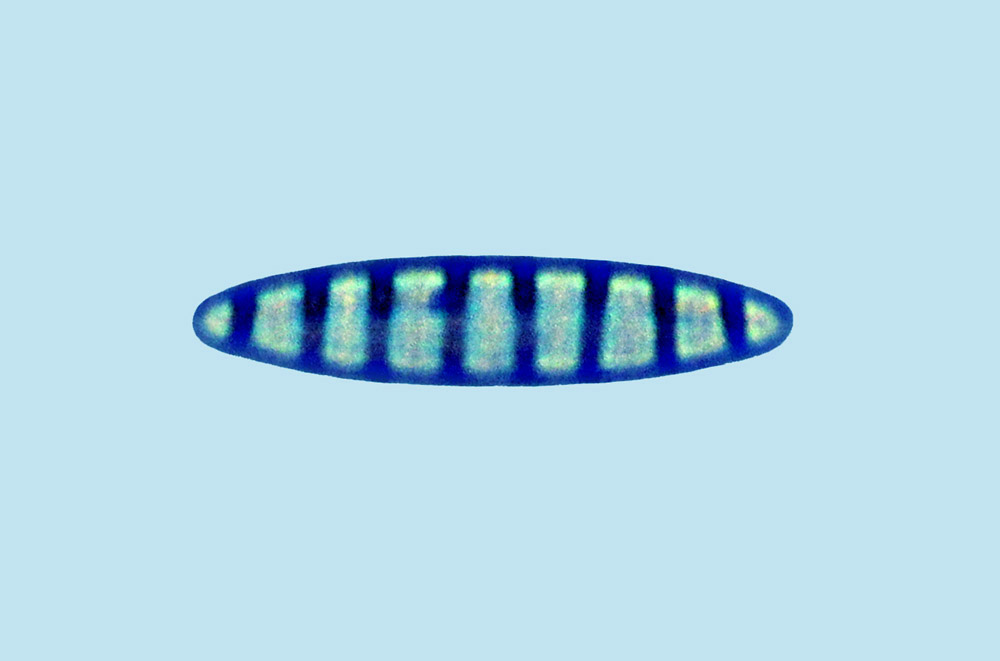 Denticula neritica