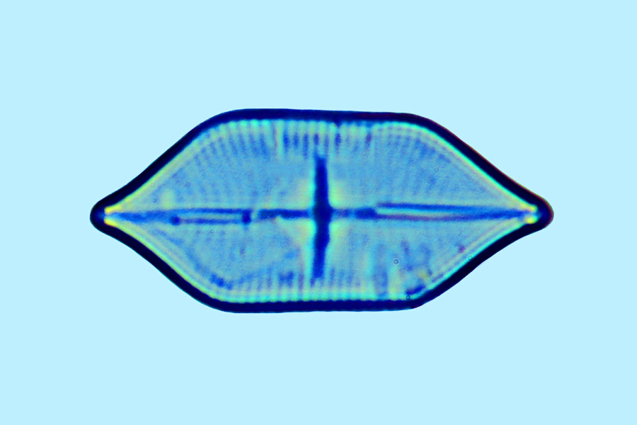 Navicula quadriseriata