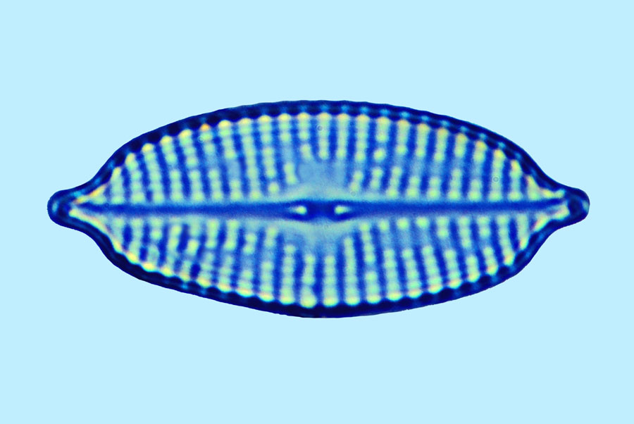 Navicula sp