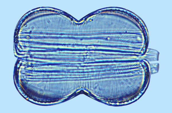 Auricula intermedia