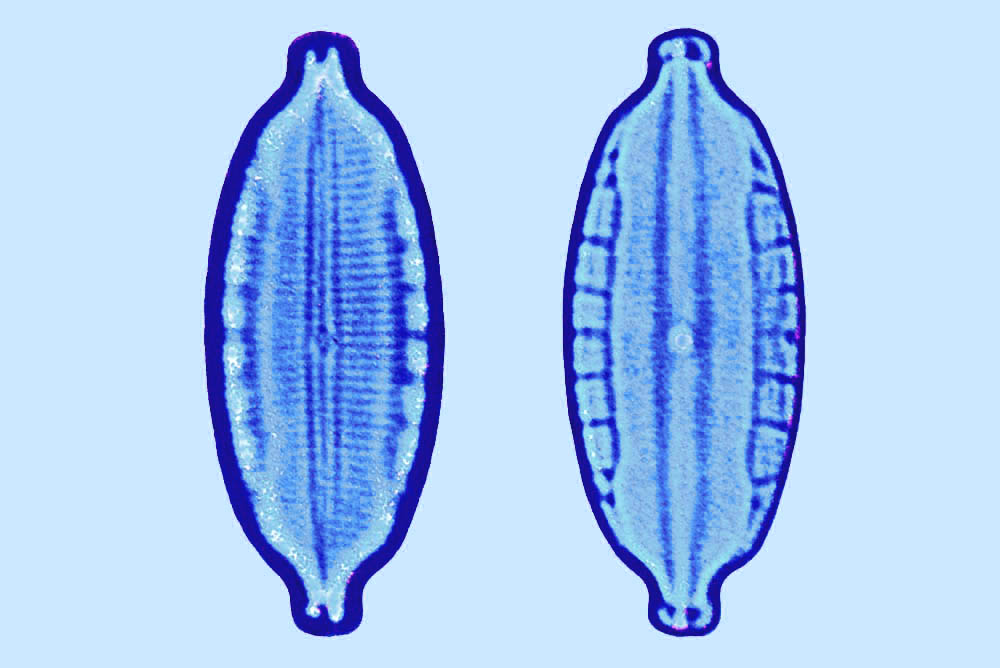 Mastogloia laterostrata