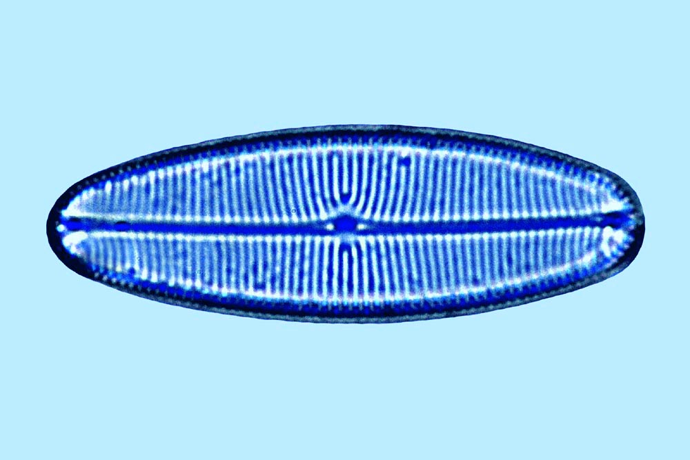 Navicula sp