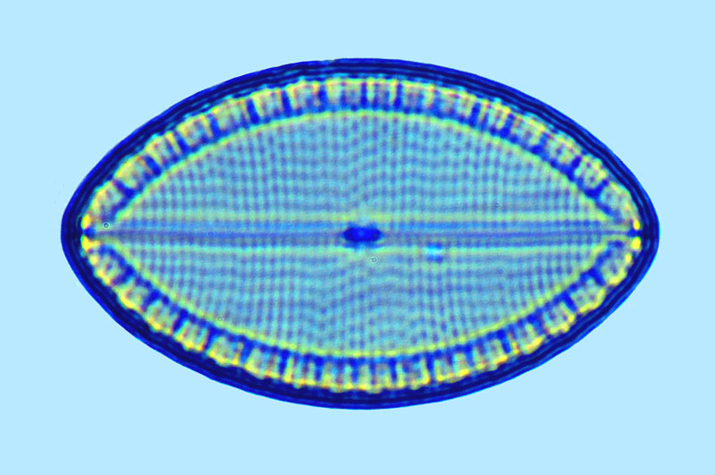 mastoglia ovata