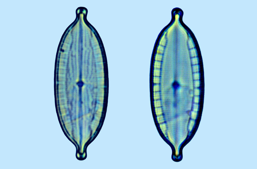 mastogloia ignorata