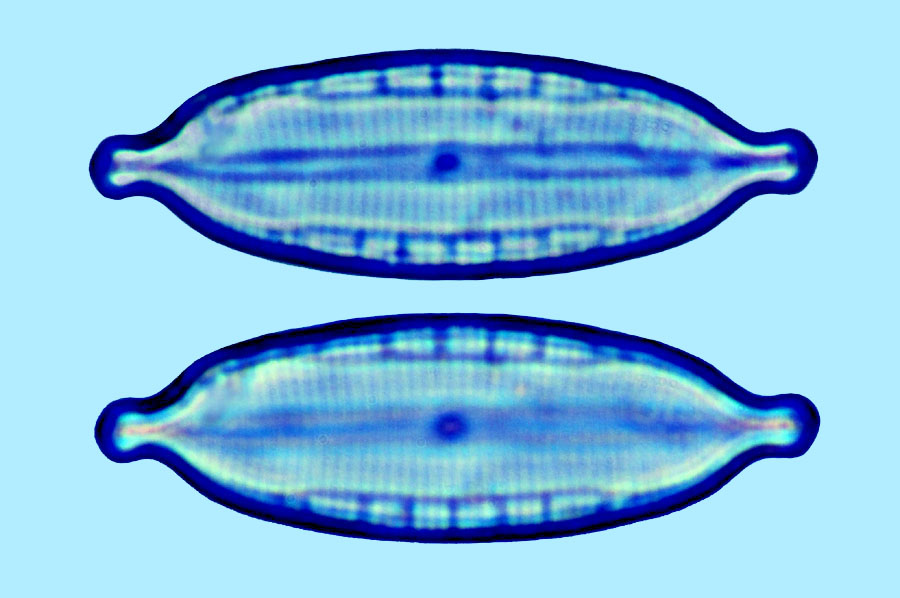 mastoglia laterostrata