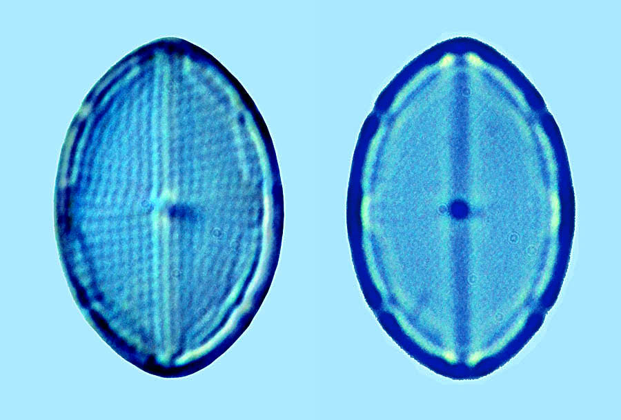 mastogloia ovulum