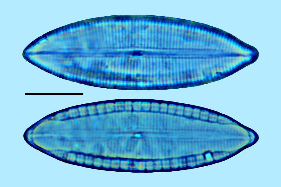 Mastogloia acutiuscula