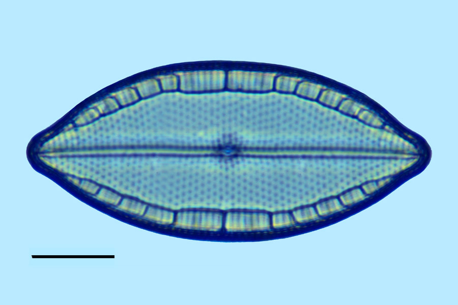 Mastogloia angulata