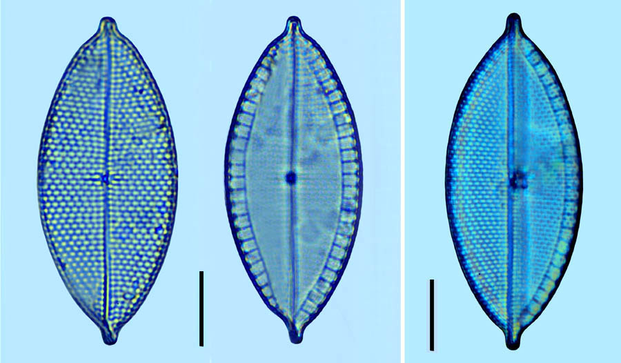 Mastogloia asperula