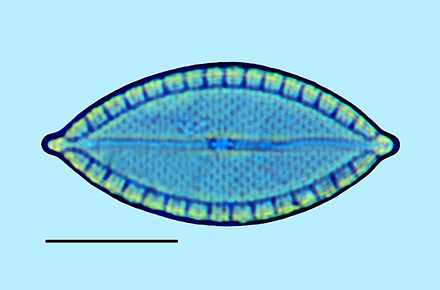 Mastogloia asperuloides