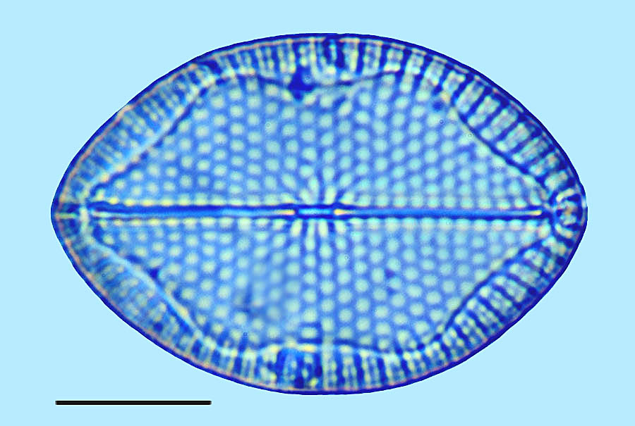 Mastogloia fimbriata