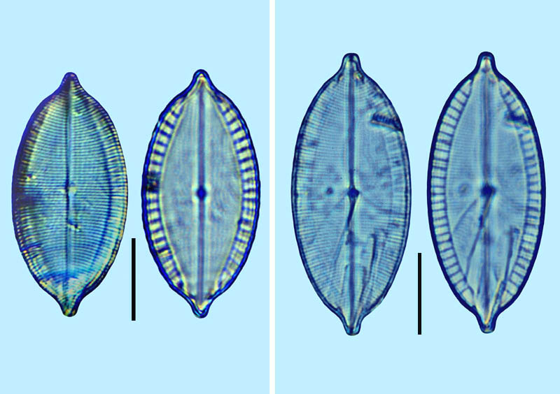 Mastogloia ignorata