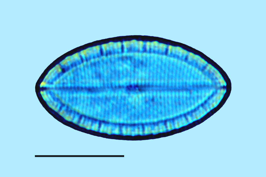 Mastogloia ovulum