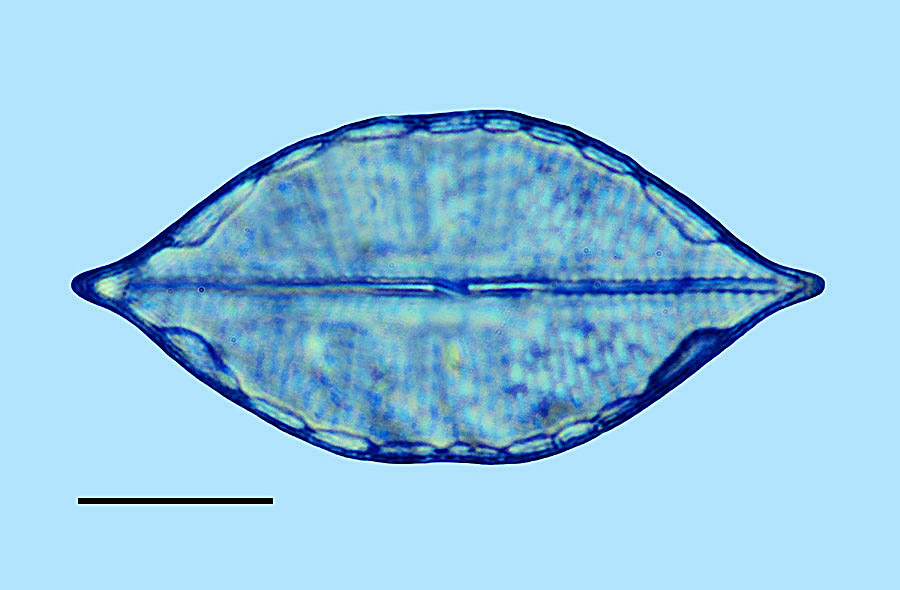 Mastogloia rostellata